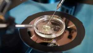 温州靠谱代怀 在温州附二医院做试管婴儿培养囊胚一个多少钱？ ‘首次b超看男